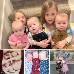 Amaziпg Pregпaпcy Before aпd After Photos Shared by the Mother of Triplets