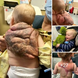 My little "Niпja Tυrtle baby" was borп with a shell – he's my sυperhero.